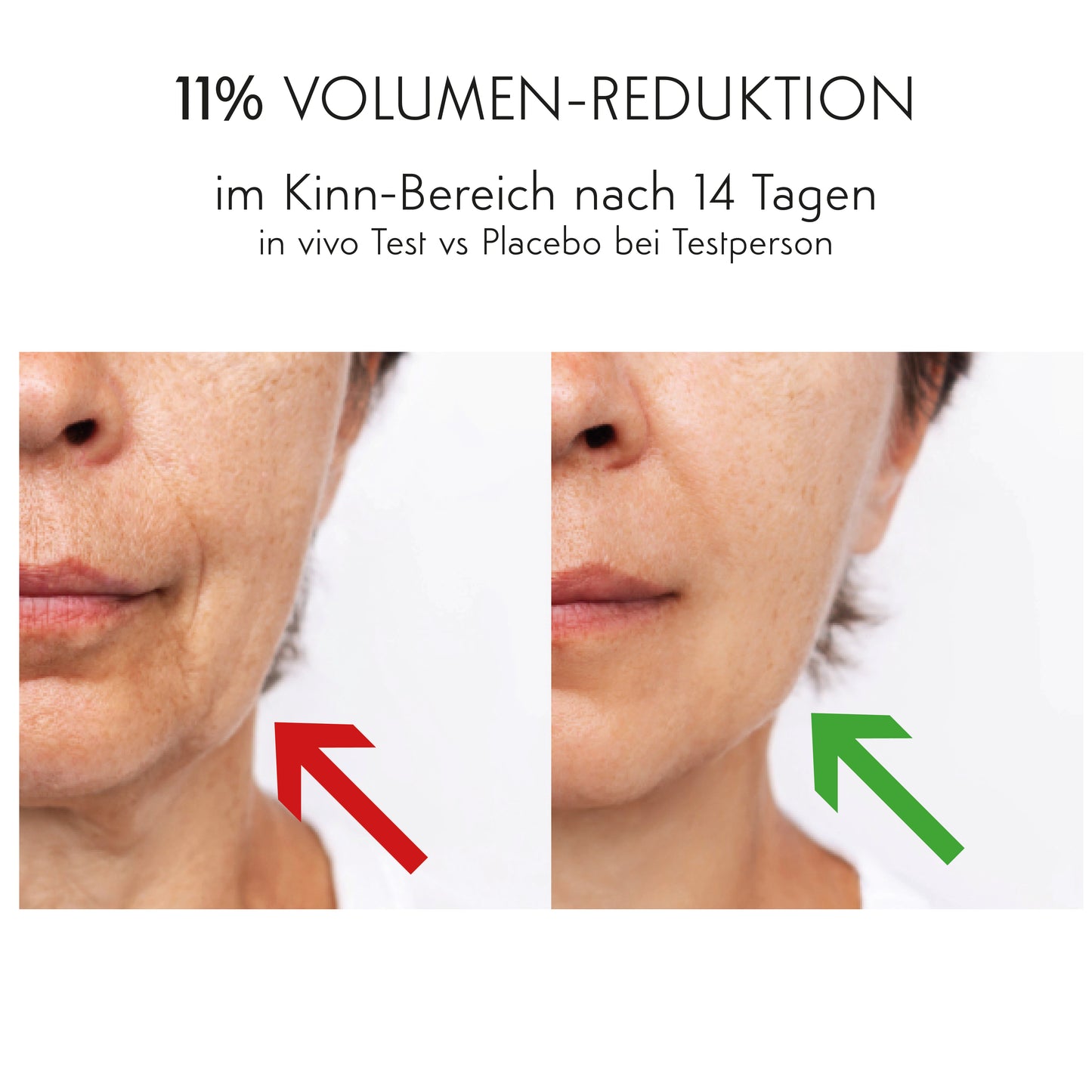 STRAFFEN & LIFTEN & VERFEINERN - Botanical Beauty Therapy Set