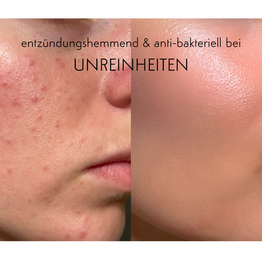 Phyto Gold Gel - Beruhigung & Repair - entzüngunshemmend, antibakteriell