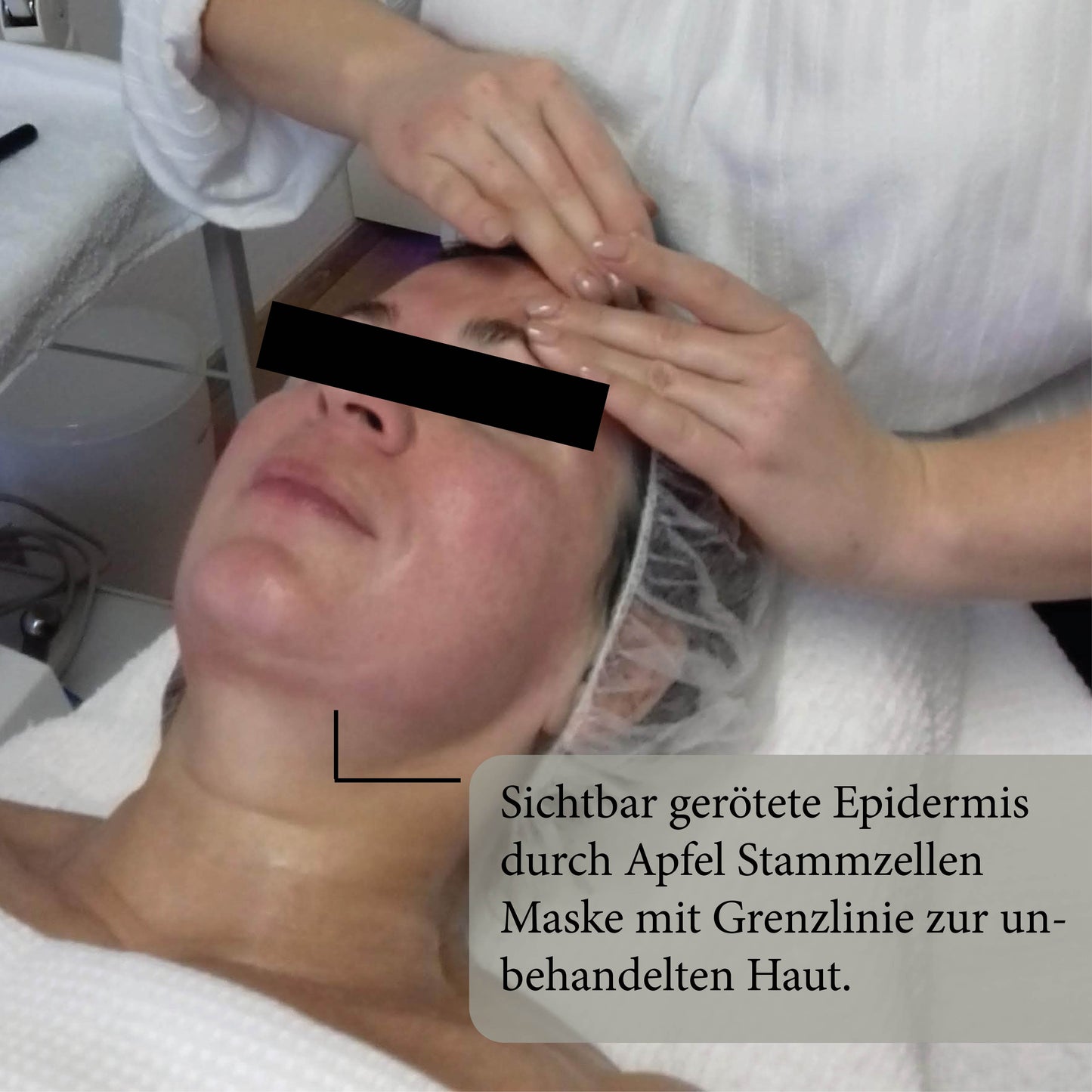 Apple Stem Cell Mask - Sofort Lifting-Effekt