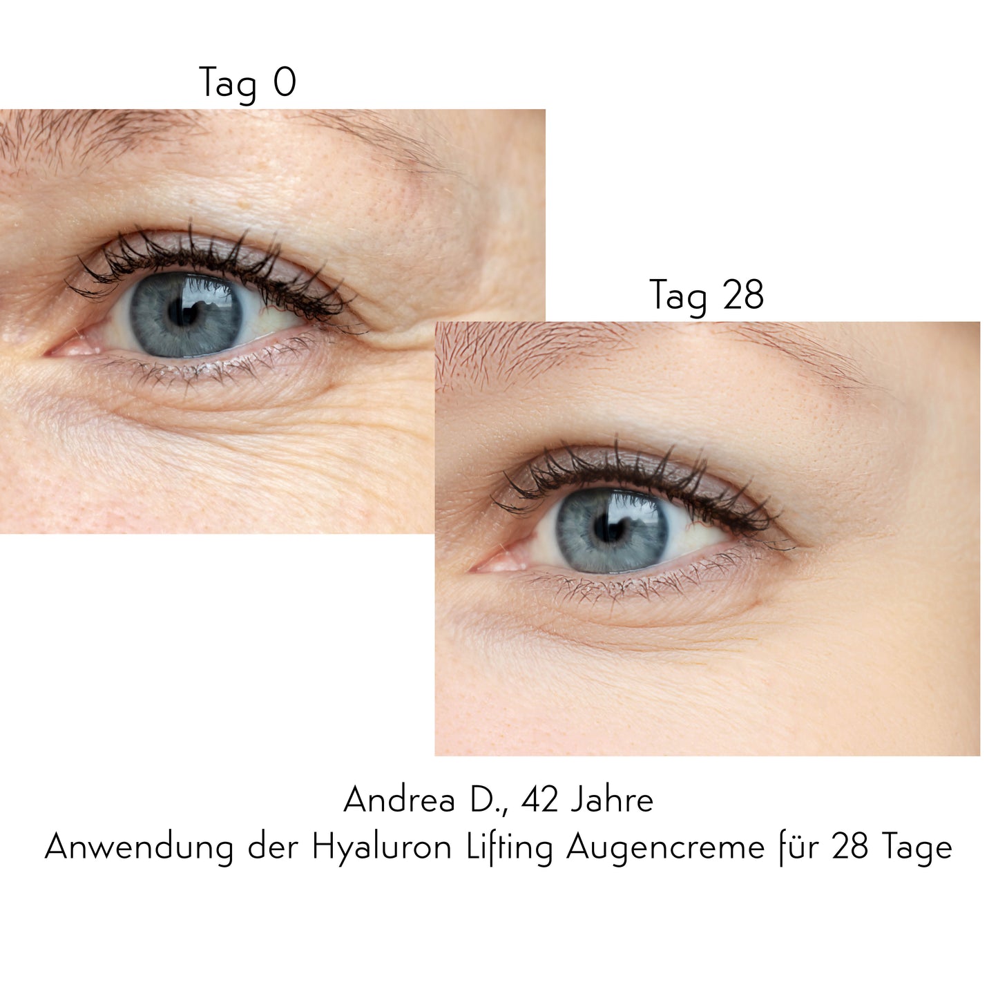 STRAFFT/ GLÄTTET/ POLSERT AUF AUGEN-CREME - Hyaluronic Eye Lifting Augencreme