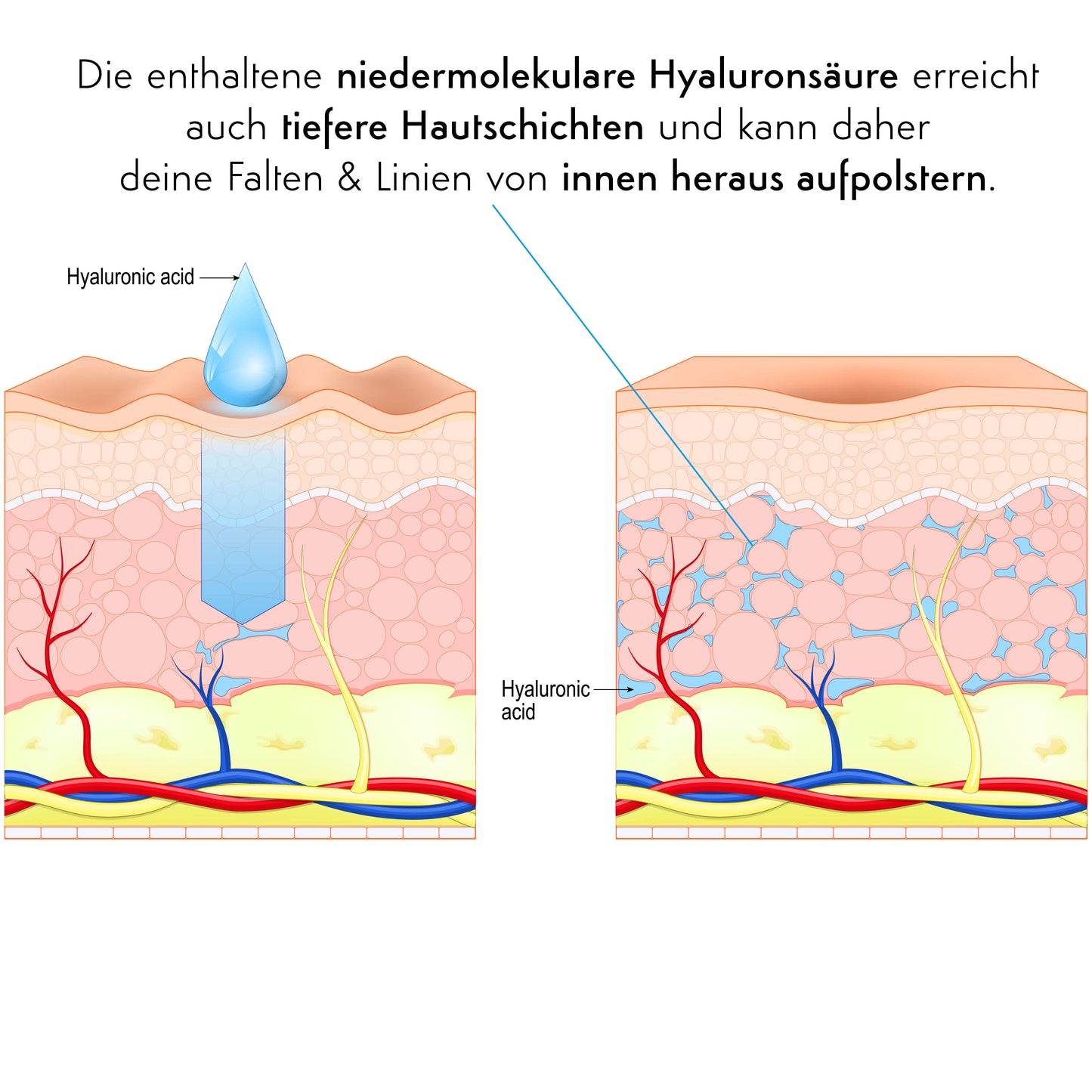 STRAFFT/ GLÄTTET/ POLSERT AUF AUGEN-CREME - Hyaluronic Eye Lifting Augencreme