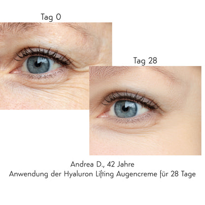 STRAFFT/ GLÄTTET/ POLSERT AUF AUGEN-CREME - Hyaluronic Eye Lifting Augencreme