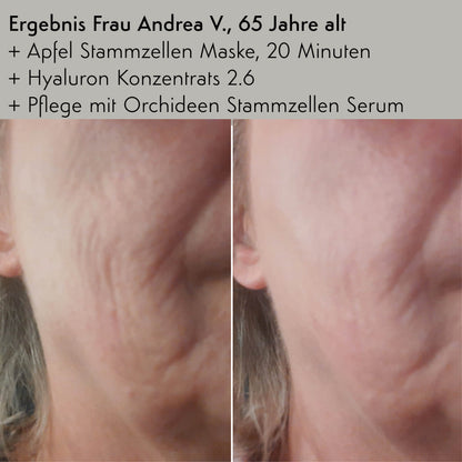 Phyto Stammzellen Set - Regeneration und Lifting für anspruchsvolle Haut