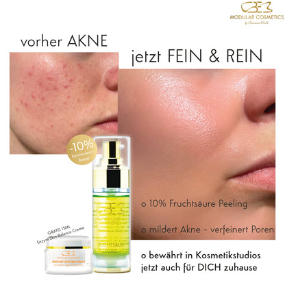 AKNE/ PIGMENTFLECKEN/ NARBEN/ POREN - Fruchtsäure Fluid + Enzym Creme 15ml gratis