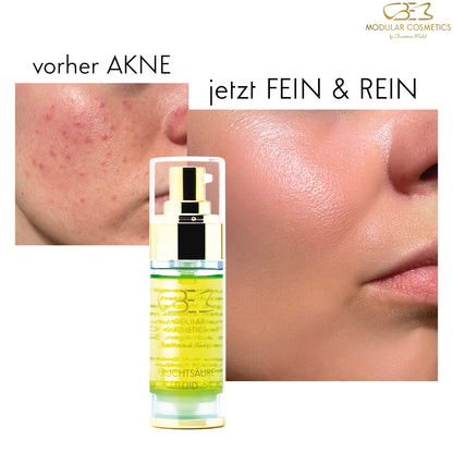 AKNE/ PIGMENTFLECKEN/ NARBEN/ POREN - Fruchtsäure Fluid + Enzym Creme 15ml gratis