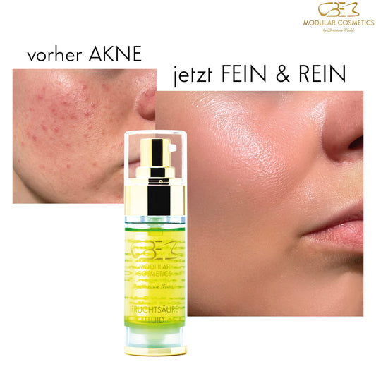 AKNE/ PIGMENTFLECKEN/ NARBEN/ POREN - Fruchtsäure Fluid + Enzym Creme 15ml gratis